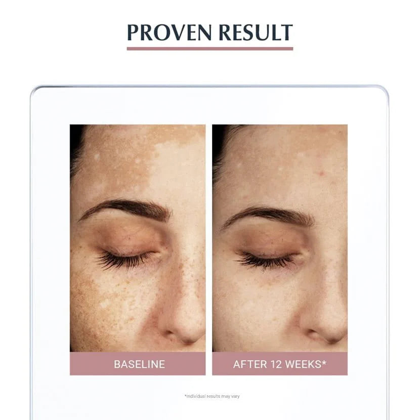 Eucerin Ultra White+ Spotless Gentle Cleansing Foam