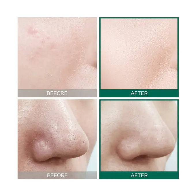 Some By Mi AHA. BHA. PHA 30 Days Miracle Toner Rose Cosmetics