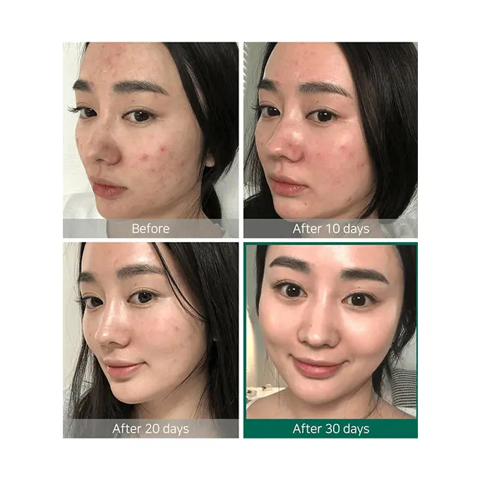 Some By Mi AHA. BHA. PHA 30 Days Miracle Toner Rose Cosmetics