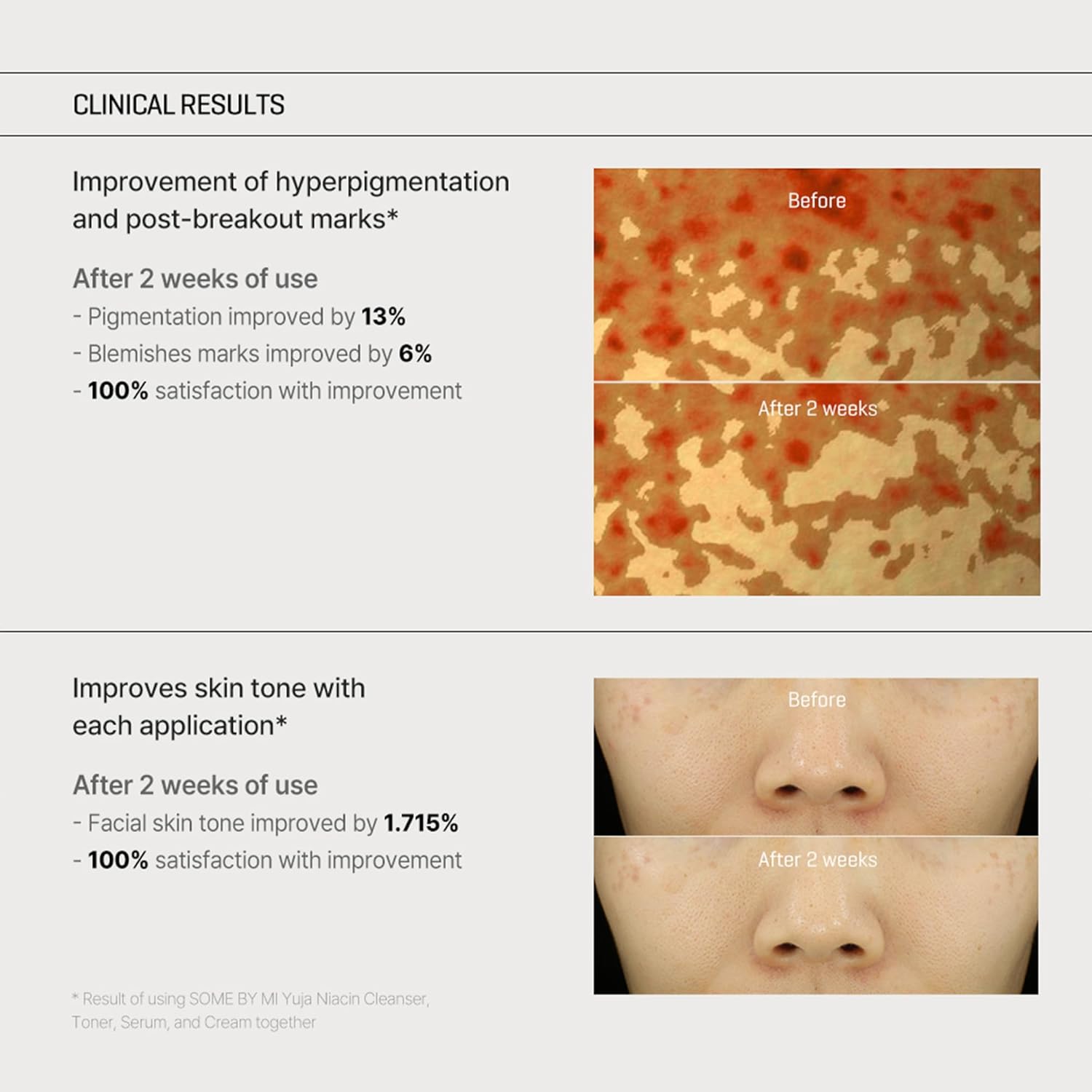 SOME BY MI - Yuja Niacin Anti Blemish Cream