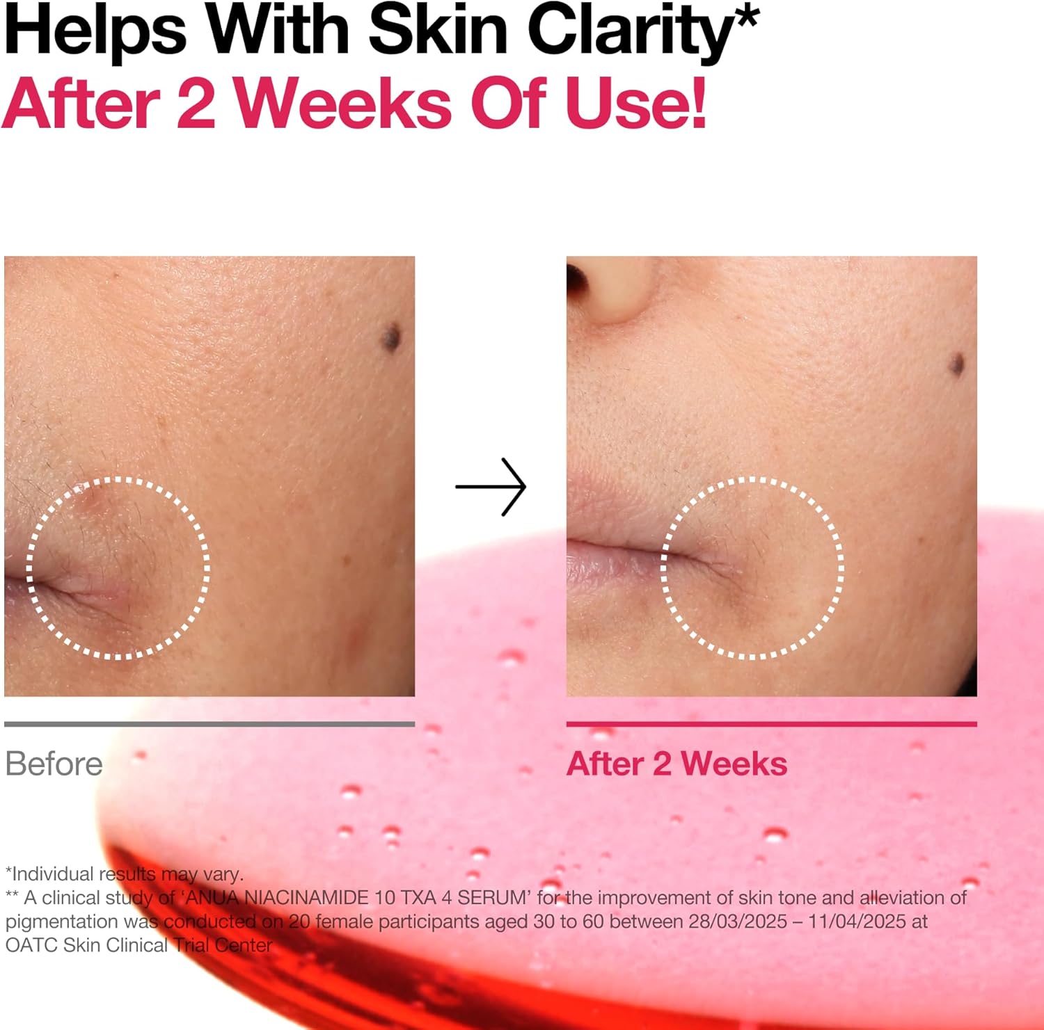 Anua Niacinamide 10% + txa 4% Serum