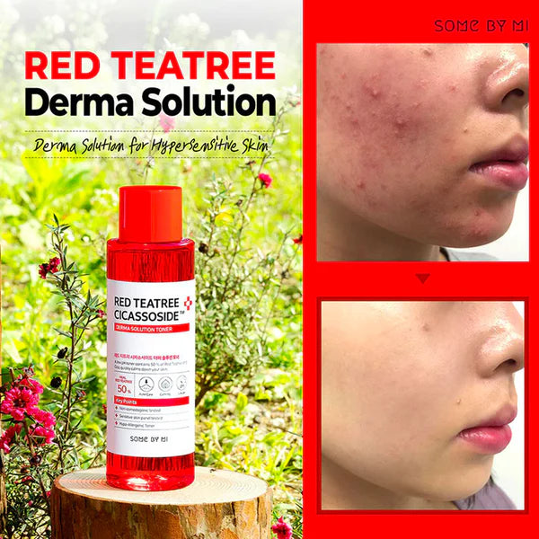 Some By Mi Red TeaTree Cicassoside Final Solution Toner