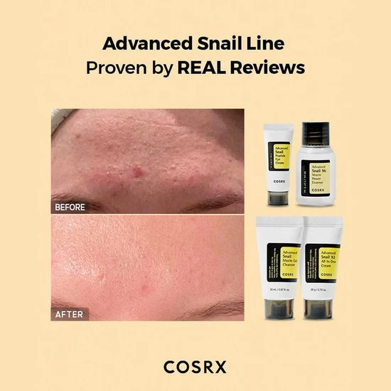 COSRX ALL ABOUT SNAIL KIT FOR DRY SKIN & DARK SPOT 50% off