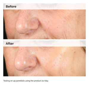 Alpha-Arbutin-2_-_-HA-gallery-1-1.png The Ordinary Alpha Arbutin 2% HA Serum – 30ml