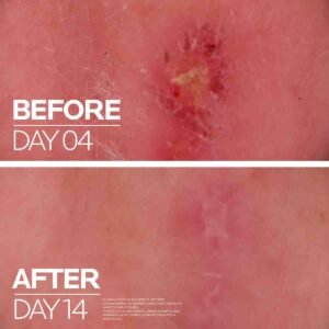 lrp-eretail-product-page-atf-before-after2022 (1) `La Roche Protection & Repair Duo ( Anthelios Uvmune 400 SPF50+ Sunscreen + Cicaplast Baume B5+ Soothing Repairing Balm)