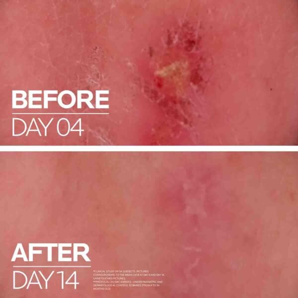 lrp-eretail-product-page-atf-before-after2022 (1) `La Roche Protection & Repair Duo ( Anthelios Uvmune 400 SPF50+ Sunscreen + Cicaplast Baume B5+ Soothing Repairing Balm)